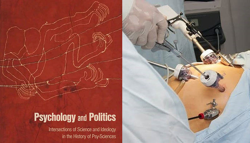 Անհետաձքելի անխուափելի վիրահատութեան շտապ պահանջք - Քաղաքականություն և հոգեբանություն